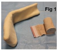 splint