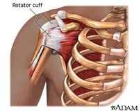 3047 Rotator Cuff