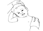 inclinar el cuello del niño