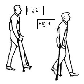 weight bearing