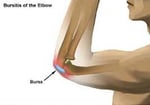 elbow pain