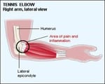 elbow