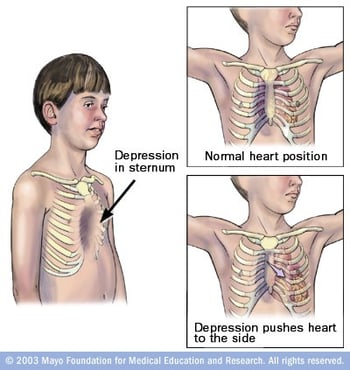 sternum