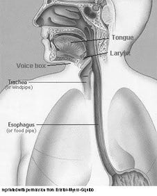 diagram of trach tube and human body