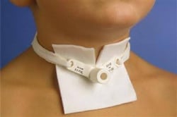 close up of child with trach vent