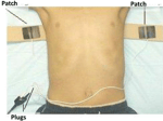Belt leads on patient