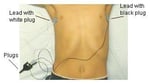 Sticky leads on patient