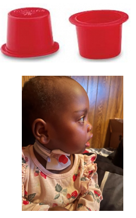 1483 - Trach cap