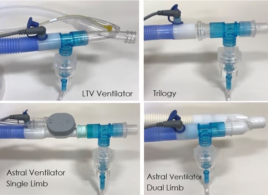 trach vent