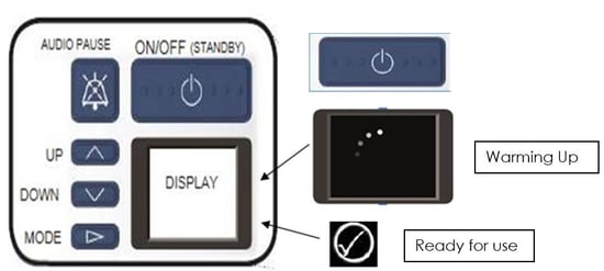 vent buttons