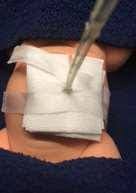Tube in dummy doll