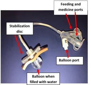 balloon