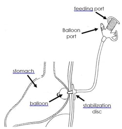 Tube