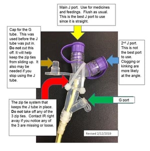 GJ tube