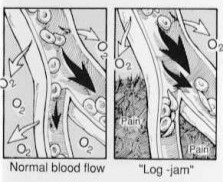 #1571 Blood flow