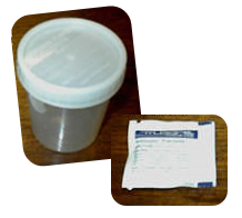 Specimen cup