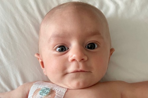 Patient Parker as an infant looking at the camera