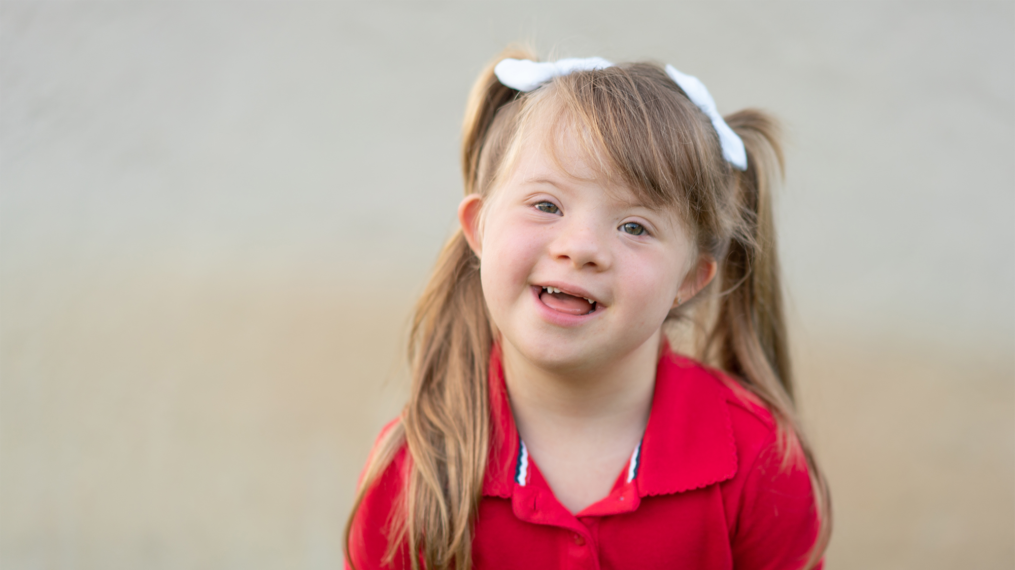 Young girl with down syndrome
