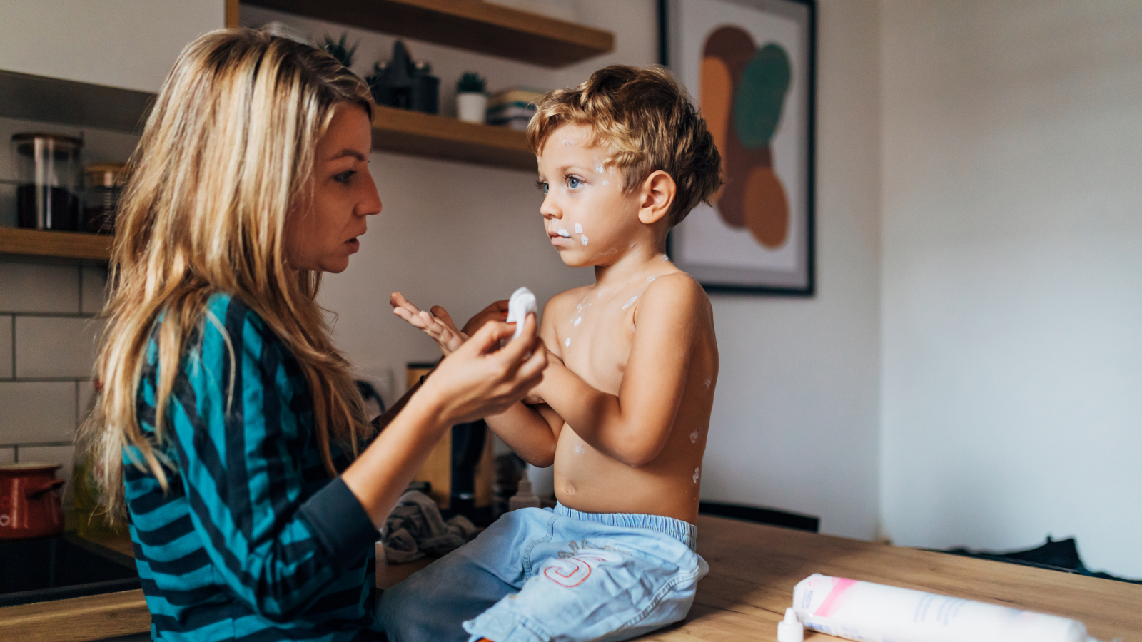 mom applies measles ointment to child