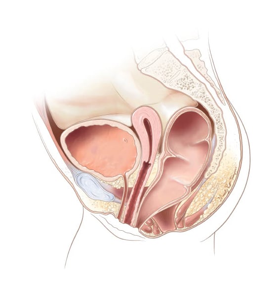 Rectooperational fistula diagram