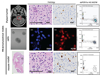 PM derived preclinical models