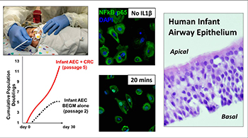 Human infant airway epithelium