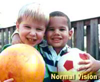 Normal Vision
