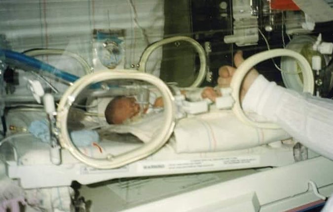 150 Years Stronger Patient Story Jody