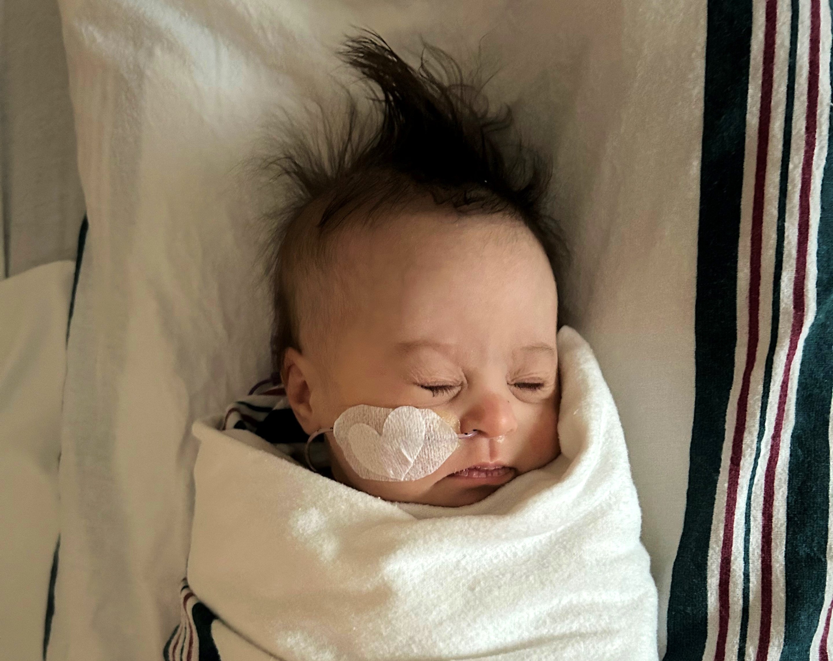 Annie as a baby at Children's National
