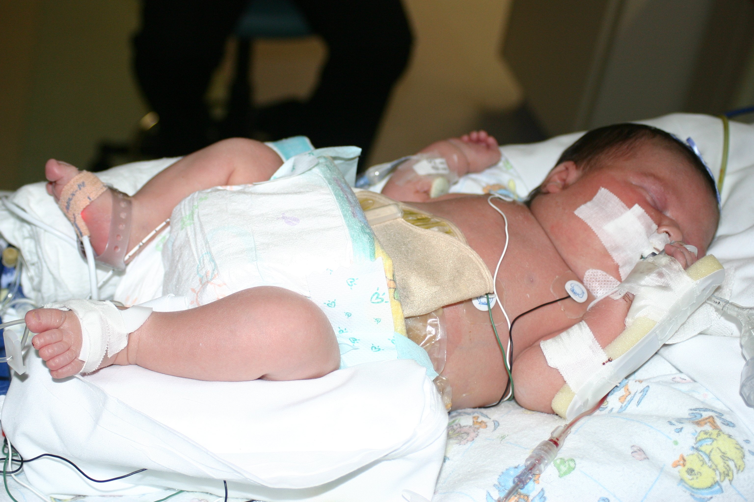 Ariana as a patient in the Neonatal Intensive Care Unit (NICU).