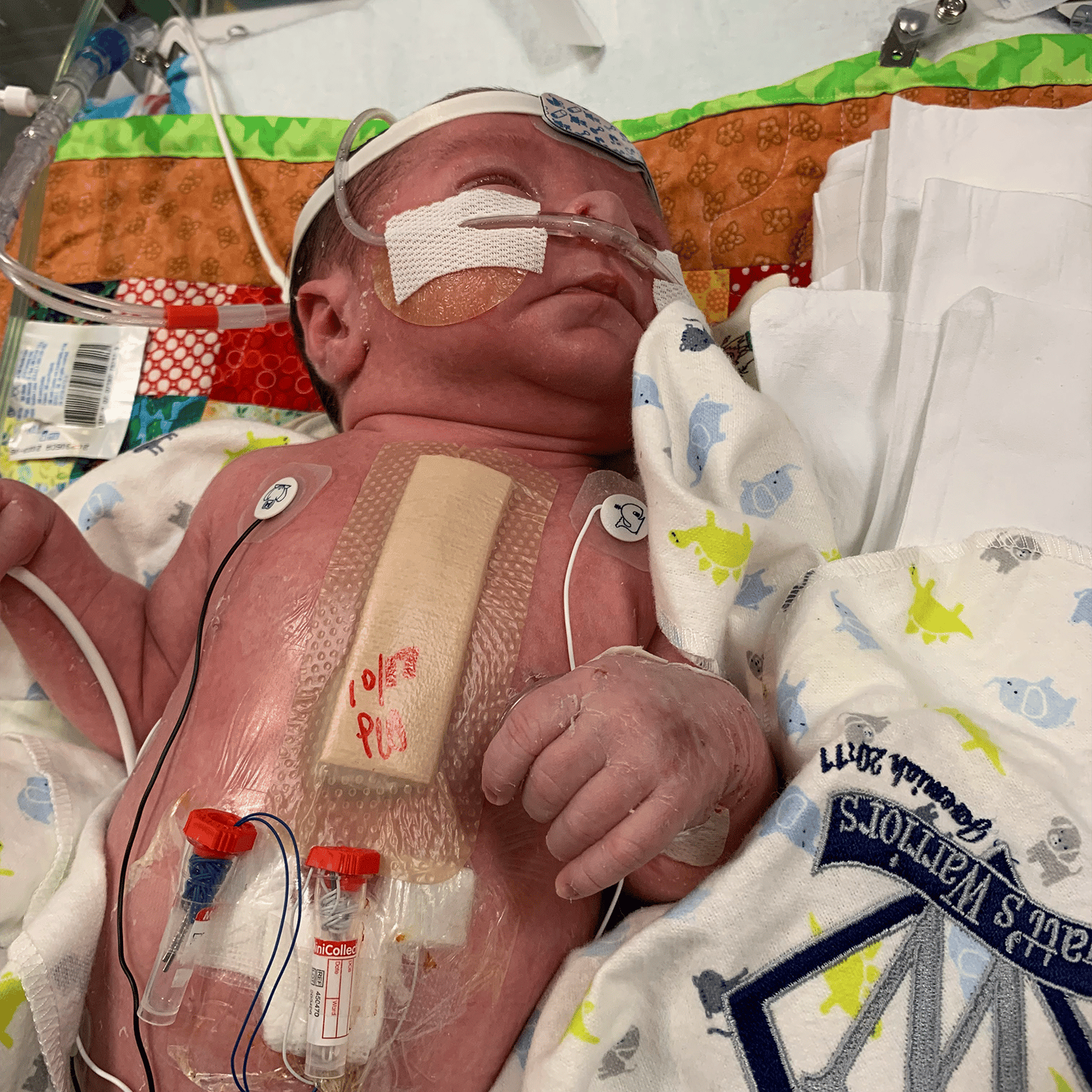 Baby with wires attached all over him