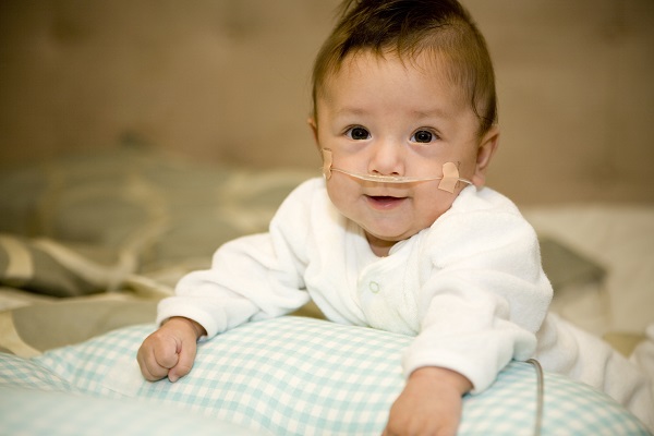 Infant on nasal cannula