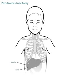 liver biopsy diagram