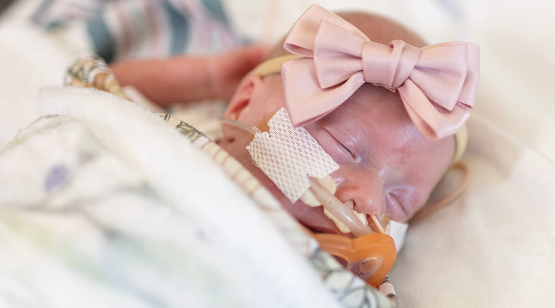 A White female premature baby gets support from a pediatric oxygenator.