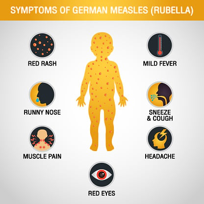 rubella