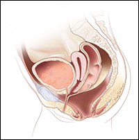 Cloaca with long common channel