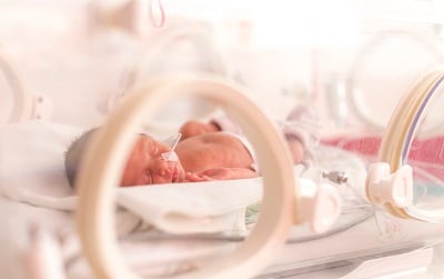 Newborn baby in the Neonatal Intensive Care Unit