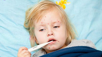 cute girl with measles