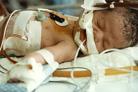 neonatal intensive care unit years of education