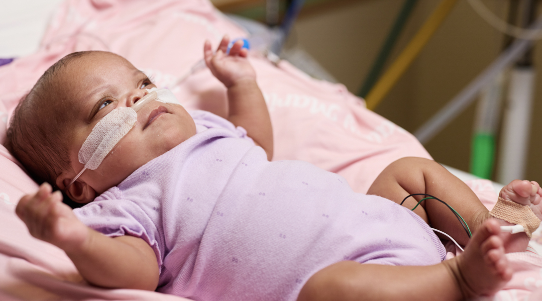 Infant laying on her back on a patient bed while breathing supplemental oxygen.