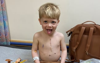 A White pre-school-aged male patient shows his chest scar.