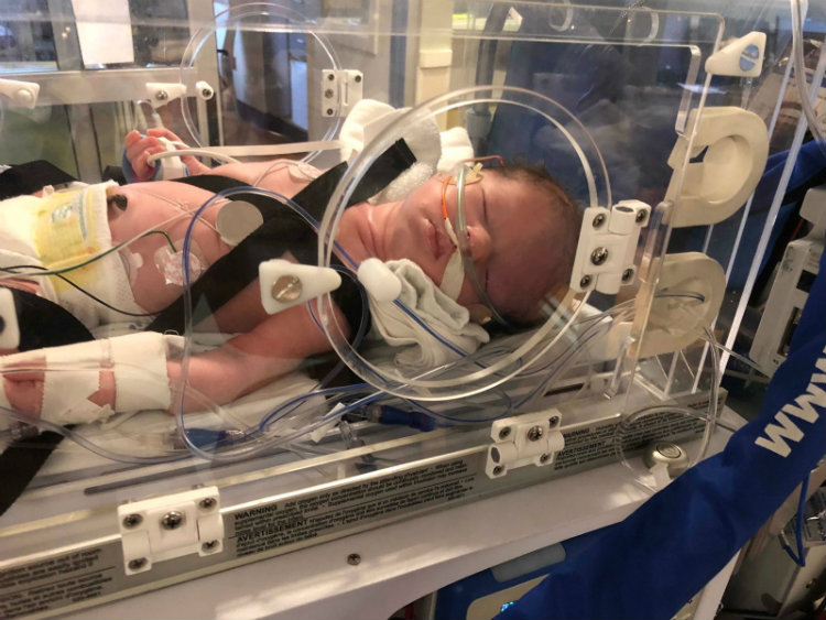 Baby Bella as a newborn in an incubator