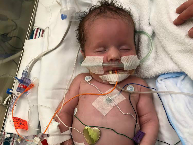 Baby Bella as a newborn in the ICU