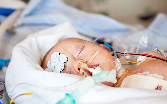A baby being treated for cardiac illness.