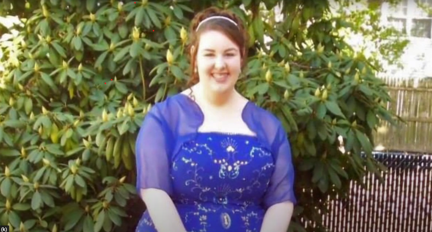 Maria after weight loss surgery