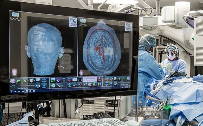 Monitors in a surgical theater display the area of the brain on which the surgeons are operating.