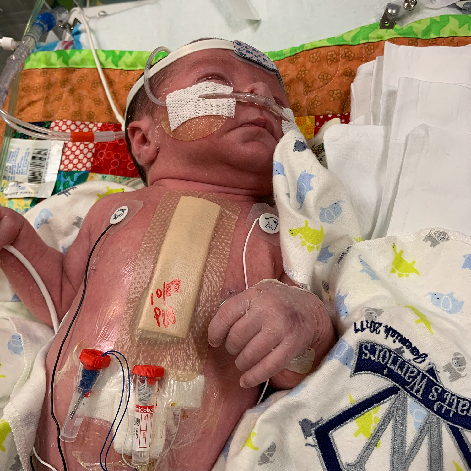 Baby with wires attached all over him