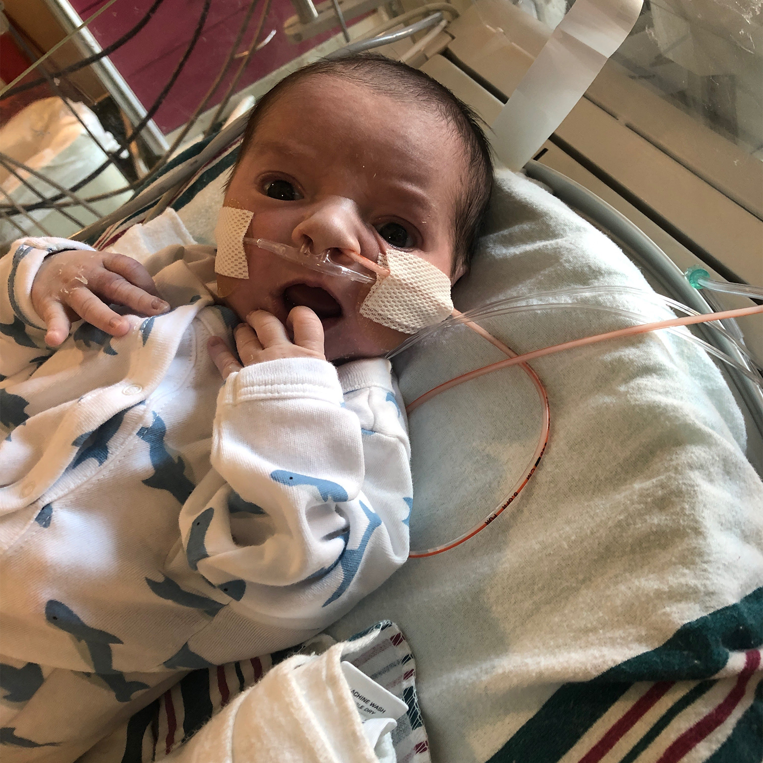 Baby with a oxygen tubes 