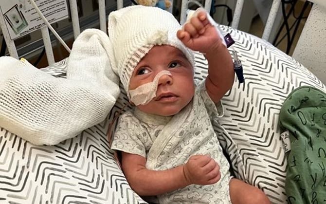 A White male infant patient who had recently undergone a lifesaving procedure at Children's National Hospital.