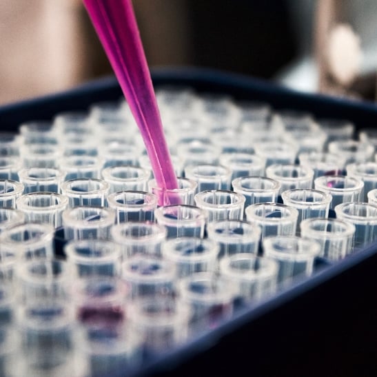 Laboratory_Pipette_S_0288-547x547-549c0e1